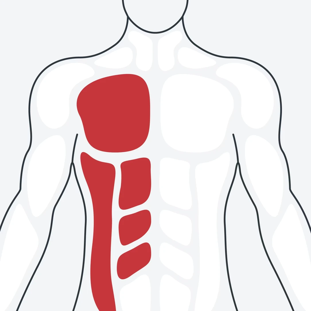 A body diagram of nerve root zones from the front